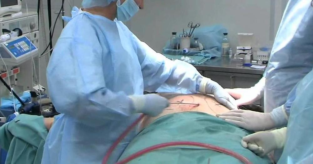 43-летняя краснодарка скончалась после пластической операции по липосакции