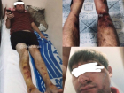 Полиция проверяет факт избиения мужчины гаишниками в Сочи