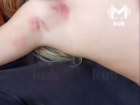 Двухлетней малышке сломали ключицу в детском садике в Краснодаре 