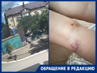 «Страшно ходить во дворе»: стая собак нападает на детей в поселке Краснодара