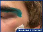 «Ударил подростка в глаз и пробил веко»: потасовка в Краснодаре закончилась больничным и уголовным делом