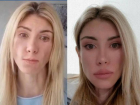 Изуродованная хирургами из Краснодара модель показала лицо после новой операции