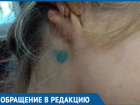Собаке удалили клеща более профессионально, чем моей дочери, - жительница Кропоткина