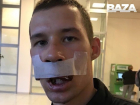 Минус 8 зубов и раскол черепа: сноубордист рассказал о ЧП на курорте в Сочи