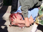 Хулиганы из Кропоткина сломали ребра и проломили голову полицейским