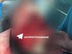 «Собака вырвала часть лица сыну»: отец растерзанного собаками мальчика рассказал о нападении