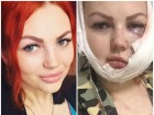  Избитой в пьяной драке жительнице Апшеронска заплатят 500 тысяч рублей 