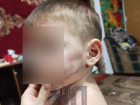 Многодетная мать и отчим избили 3-летнего малыша на Кубани 