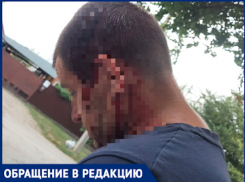 Дорожники проломили голову краснодарцу из-за просьбы не подвергать опасности детей 