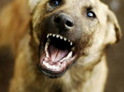 На школьницу Динского района напала злая собака: девочка в больнице