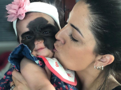 Виртуальное пятно: как перенесла операцию в Краснодаре маленькая американка с маской Бэтмена 