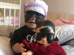 «Luna’s Doll»: девочке с «маской Бэтмена» в Краснодаре подарили куклу с родимым пятном, как у нее