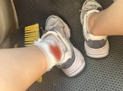 Собаки терроризируют и кусают жителей Гидростроя в Краснодаре