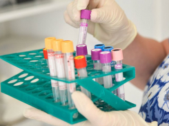 Лаборатория для исследования анализов на коронавирус открылась в Сочи