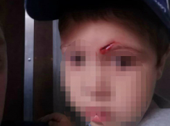 Краснодарец рассказал об отказе принимать окровавленного ребенка в БСМП