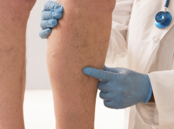 Лечили варикоз повязками и матрасами: в Краснодаре идет под суд банда лжеврачей за мошенничество на 150 млн