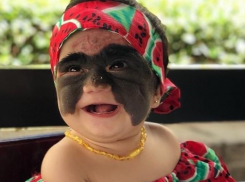 Врачи Краснодара сняли маску Бэтмена с лица маленькой американки