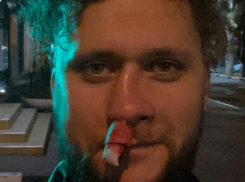 Сломал нос из-за микрофона: вокалист из Новороссийска рассказал подробности избиения