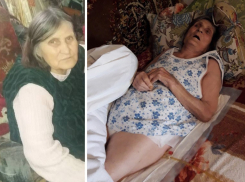 На Кубани 83-летнюю бабушку с переломом перевели в ковидный госпиталь и отправили домой умирать