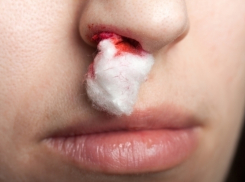 В Новороссийске женщине разбили нос в почтовом отделении