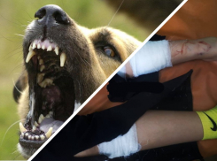 Свора собак напала на 11-летнюю девочку возле парка Галицкого