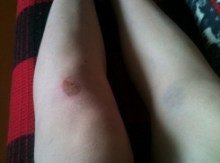 Беременная девушка вышла из маршрутки на ходу и разбила колени