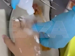 В Краснодаре 9-летний мальчик лишится пальца из-за безрассудности старшеклассницы 