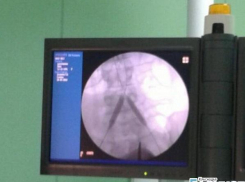 В краевом центре провели уникальную операцию