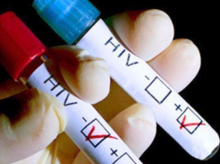 В День семьи, любви и верности жители Краснодарского края смогут узнать свой ВИЧ-статус