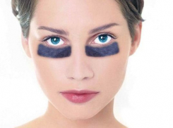 Причины появления темных кругов под глазами