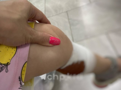 Стая бродячих собак напала на двухлетнюю девочку в Краснодаре