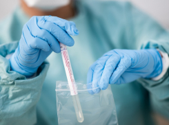 В инфекционной больнице Краснодара рассказали, как отличить коронавирус от аллергии