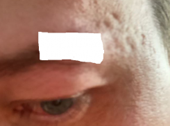 В Краснодаре избивший фельдшера скорой помощи мужчина получил полгода исправительных работ