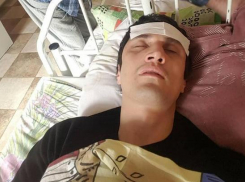 Избитый на Кубани журналист назвал причину нападения на него