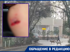 Бездомная собака вырвала кусок кожи у прохожей в Краснодаре 