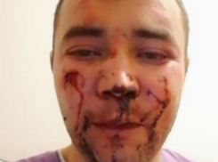 Председатель совета дома ЖК «Видный» в Краснодаре был избит двумя неизвестными 