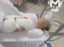 ДТП с пострадавшей школьницей в Краснодаре привлекло внимание омбудсмена России 