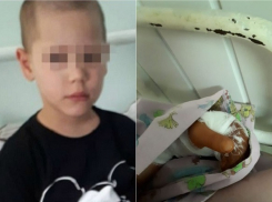 На кузнеца, по вине которого пострадал ребенок-инвалид на празднике в Краснодаре, завели уголовное дело