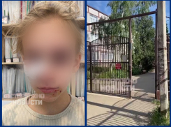 Во дворе школы в Краснодаре бездомная собака разорвала лицо 8-летней девочке 