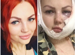  Избитой в пьяной драке жительнице Апшеронска заплатят 500 тысяч рублей 