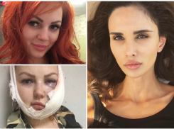 Жена игрока ФК «Краснодар» Алана Мамаева решила помочь изуродованной девушке из Апшеронска