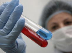  На Кубани в продаваемых продуктах нашли птичий грипп 