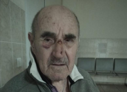 Перелом носа и предплечья: девочка на электросамокате сбила пенсионера в Краснодаре и скрылась 