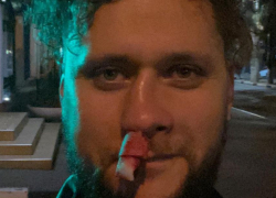 Вокалисту группы «Бакс Бани» во время выступления в Геленджике слушатель сломал нос