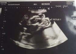 Сразу двух детей потеряла 20-летняя в роддоме Краснодара