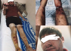 «Вытащили за ноги»: в Сочи мужчина обвинил гаишников в избиении