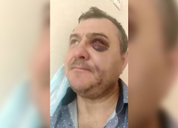 Экс-солисту группы «Лесоповал» после концерта в Сочи сломали челюсть