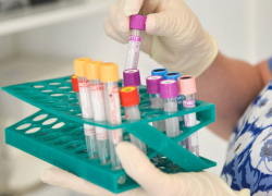 Около 70 человек попали в больницы Кубани с подозрением на коронавирус