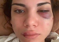 В краснодарском трамвае произошла потасовка между пассажирами