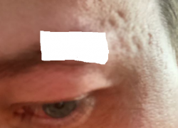 Пьяный краснодарец избил фельдшера скорой помощи до сотрясения мозга